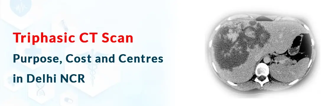 Triphasic CT Scan: Purpose, Cost  and Centres in Delhi NCR